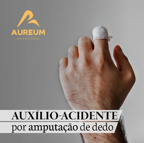 Auxílio-acidente por amputação de dedo